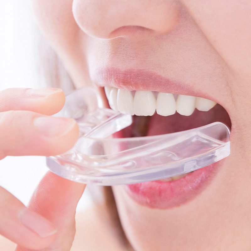 各種マウスピース製作